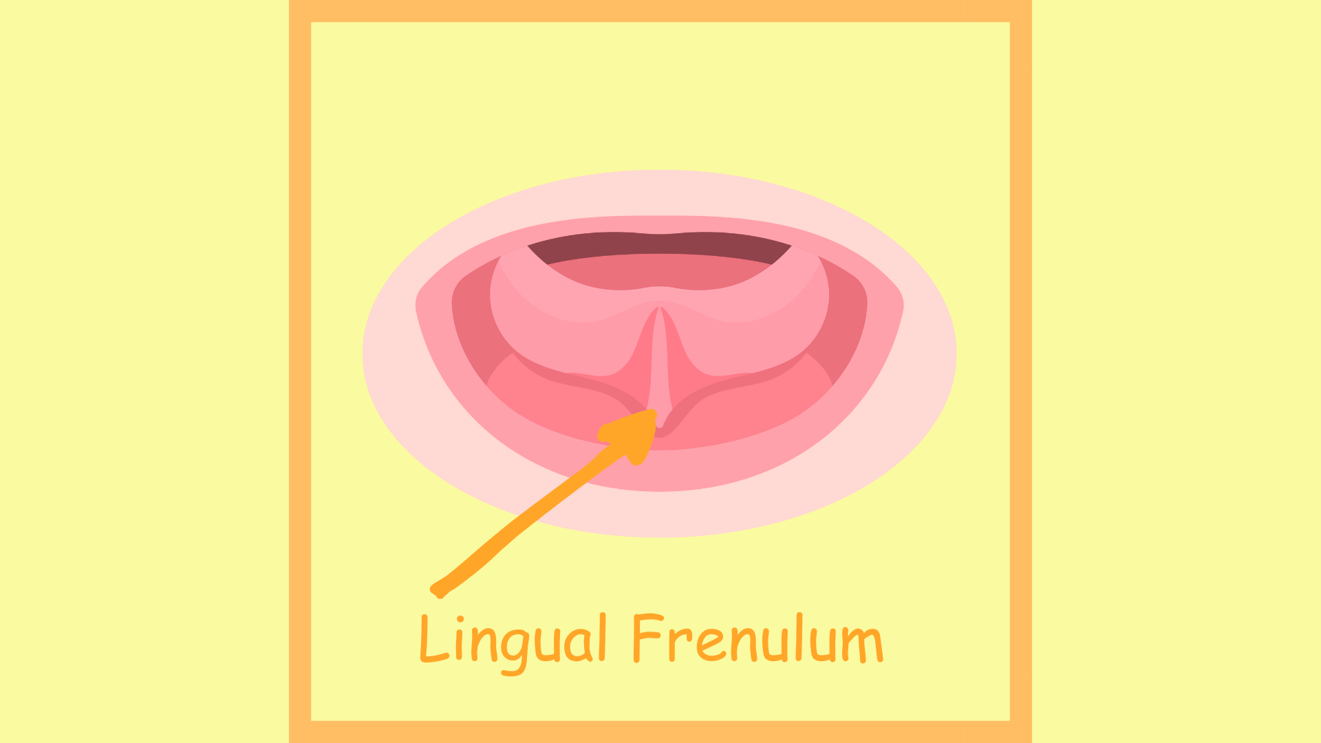 Lingual Frenulum Anatomy Diagram-