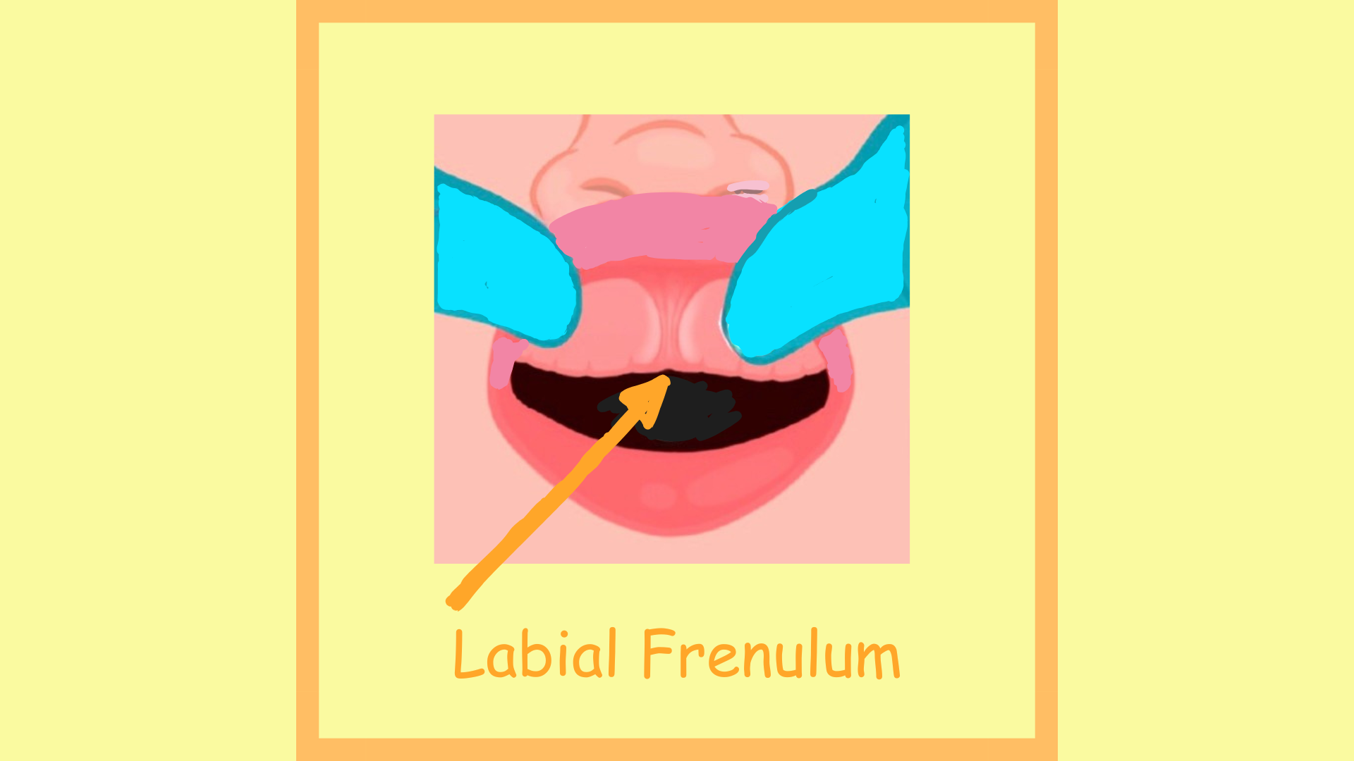 Labial-Frenulum-