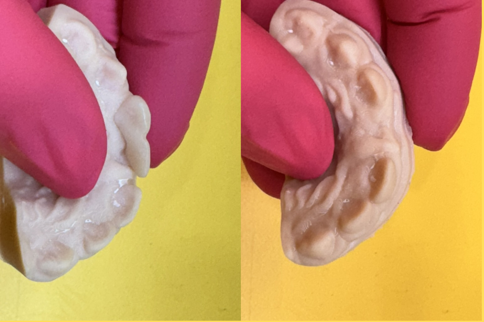 Printed model showing space of missing tooth-2