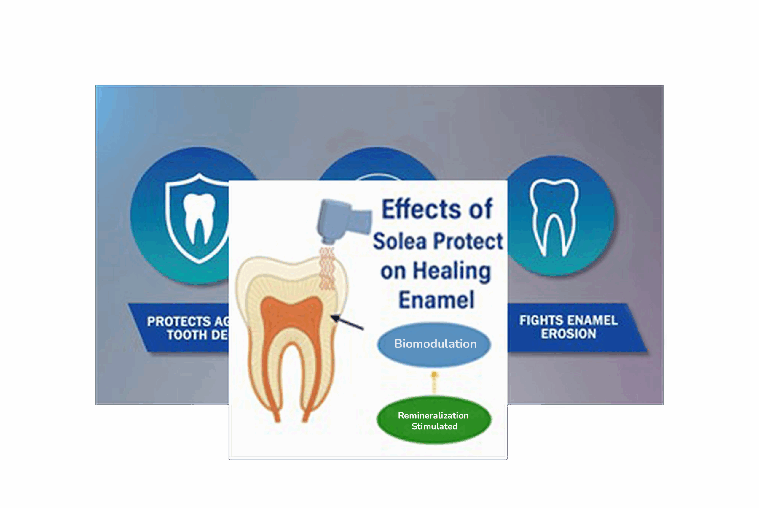 laser-dentistry-diagram-
