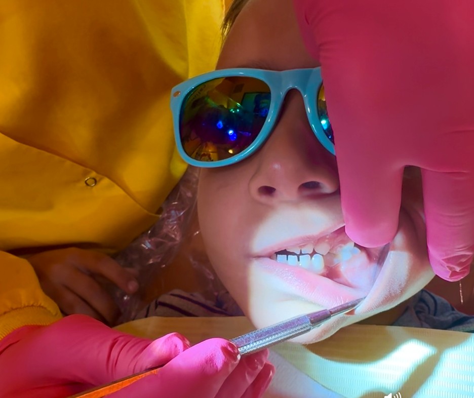 Child-Smile-Keepers-Pediatric-Space-Maintainers-3Dprinted-5