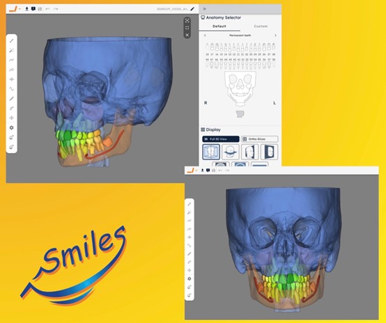 3D Digital Dental Imaging for Pediatric Diagnosis and Treatment Planning