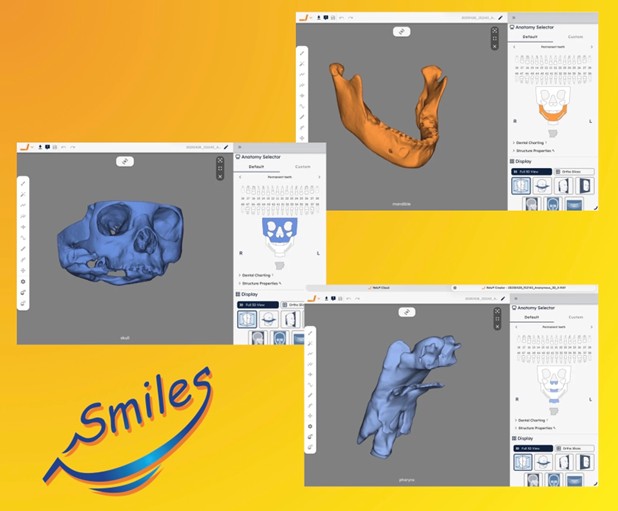 3D Digital Dental Imaging for Pediatric Diagnosis and Treatment Planning