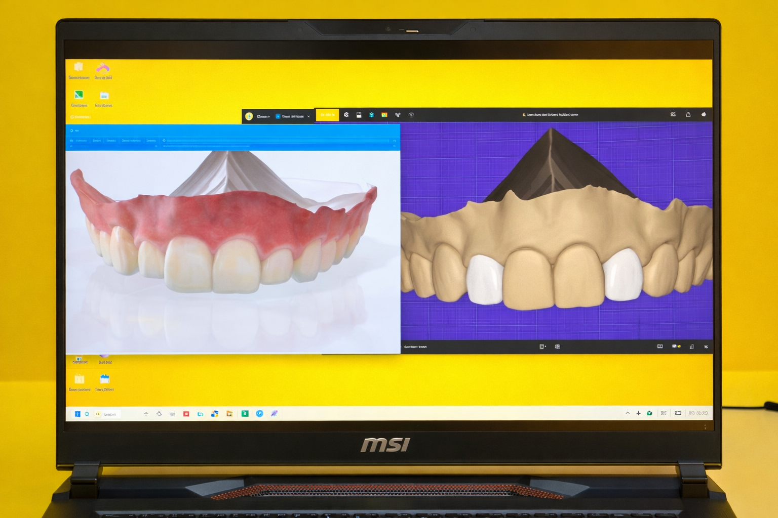 Pediatric Dentist Digital 3D Teeth Scan and Dental Modeling Technology