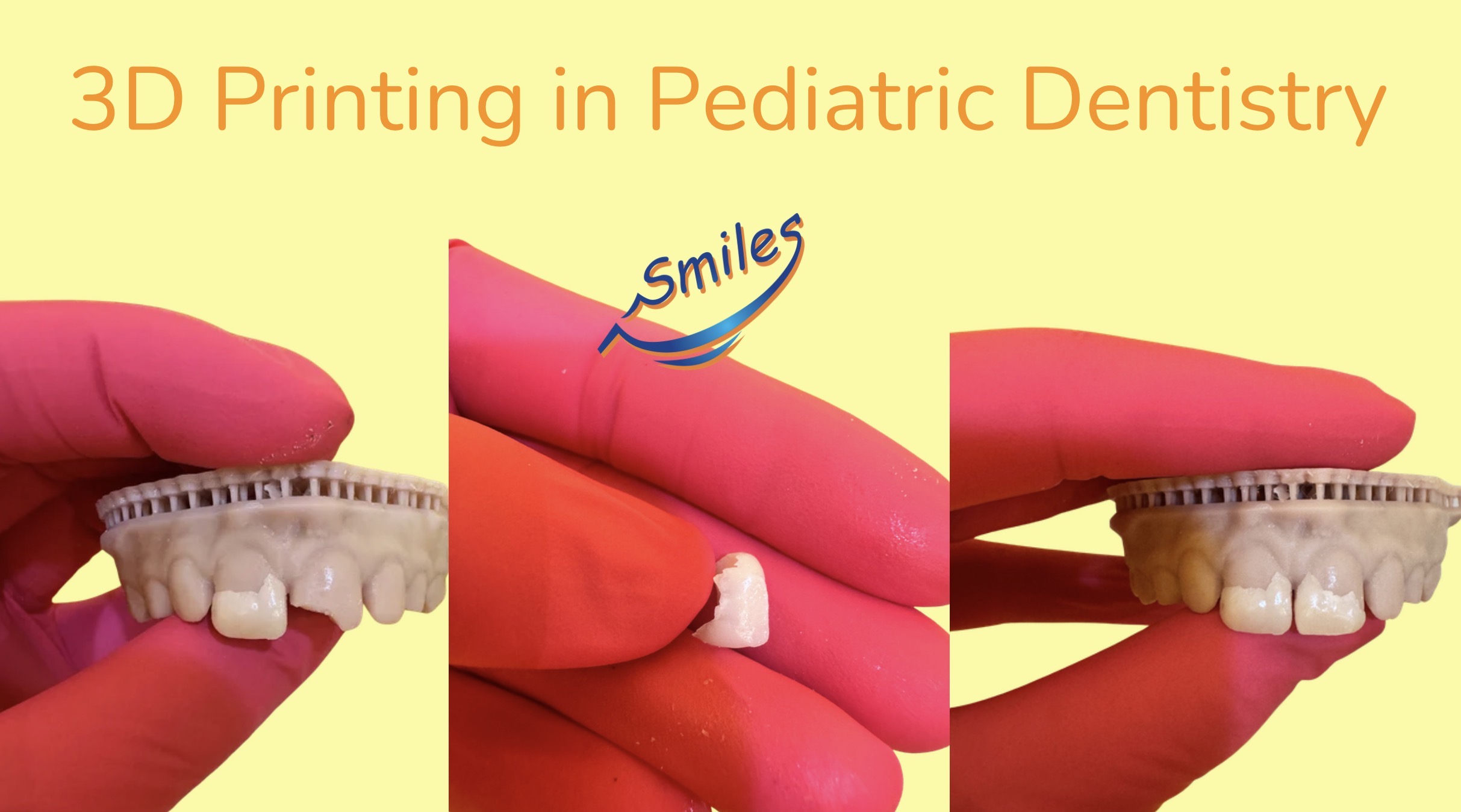 3d-printed-custom-teeth-pediatric-dental-patient
