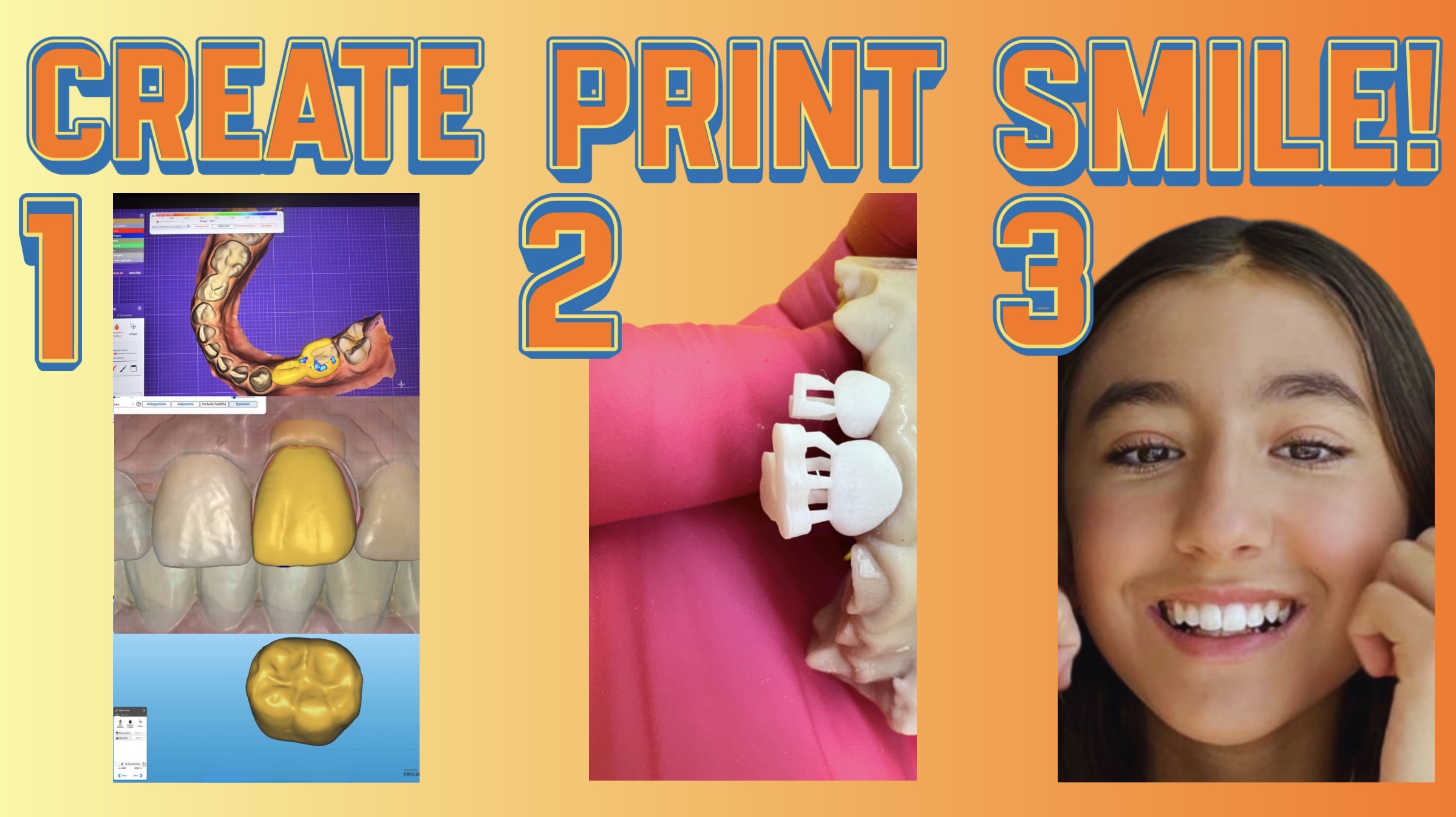 create-print-smile-3d-printing-pediatric-dentistry-workflow