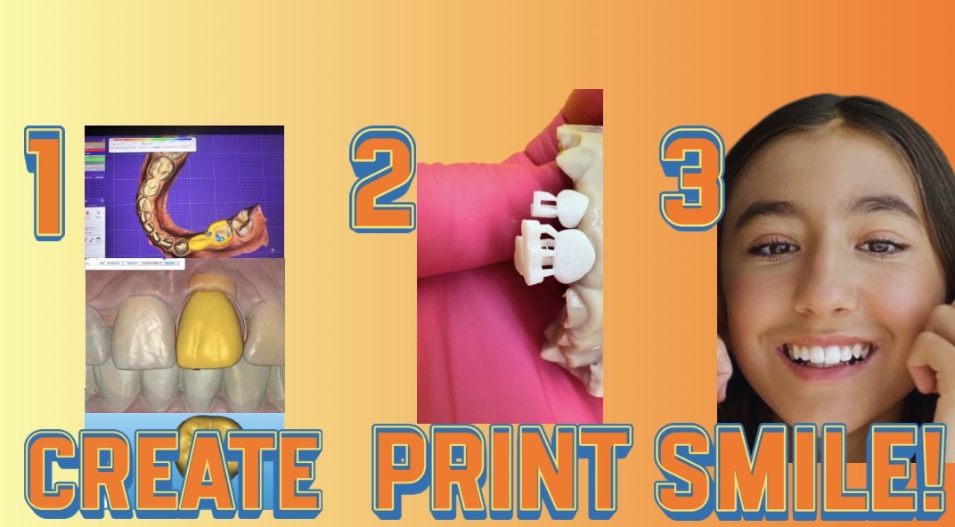 Digital Pediatric Dentistry: How 3D Printing Is Transforming the Dental Experience for Children and Teens