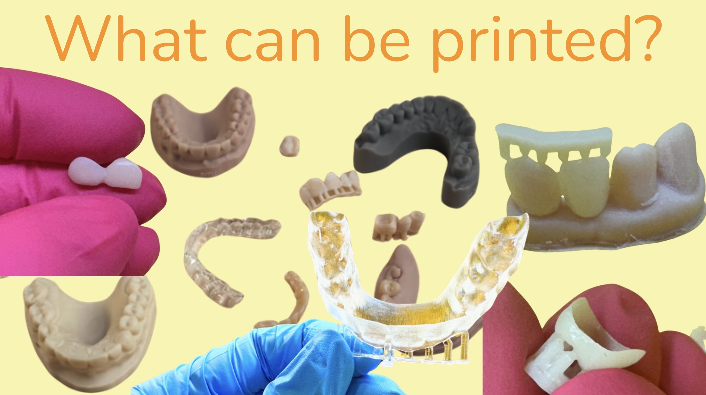 what-can-be-3d-printed-pediatric-dentistry-retainers-crowns-guards