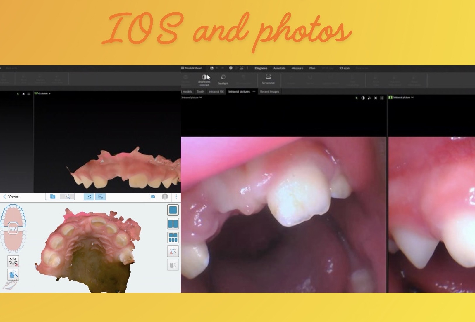 printismile-intraoral-scans-clinical-photos-primary-teeth