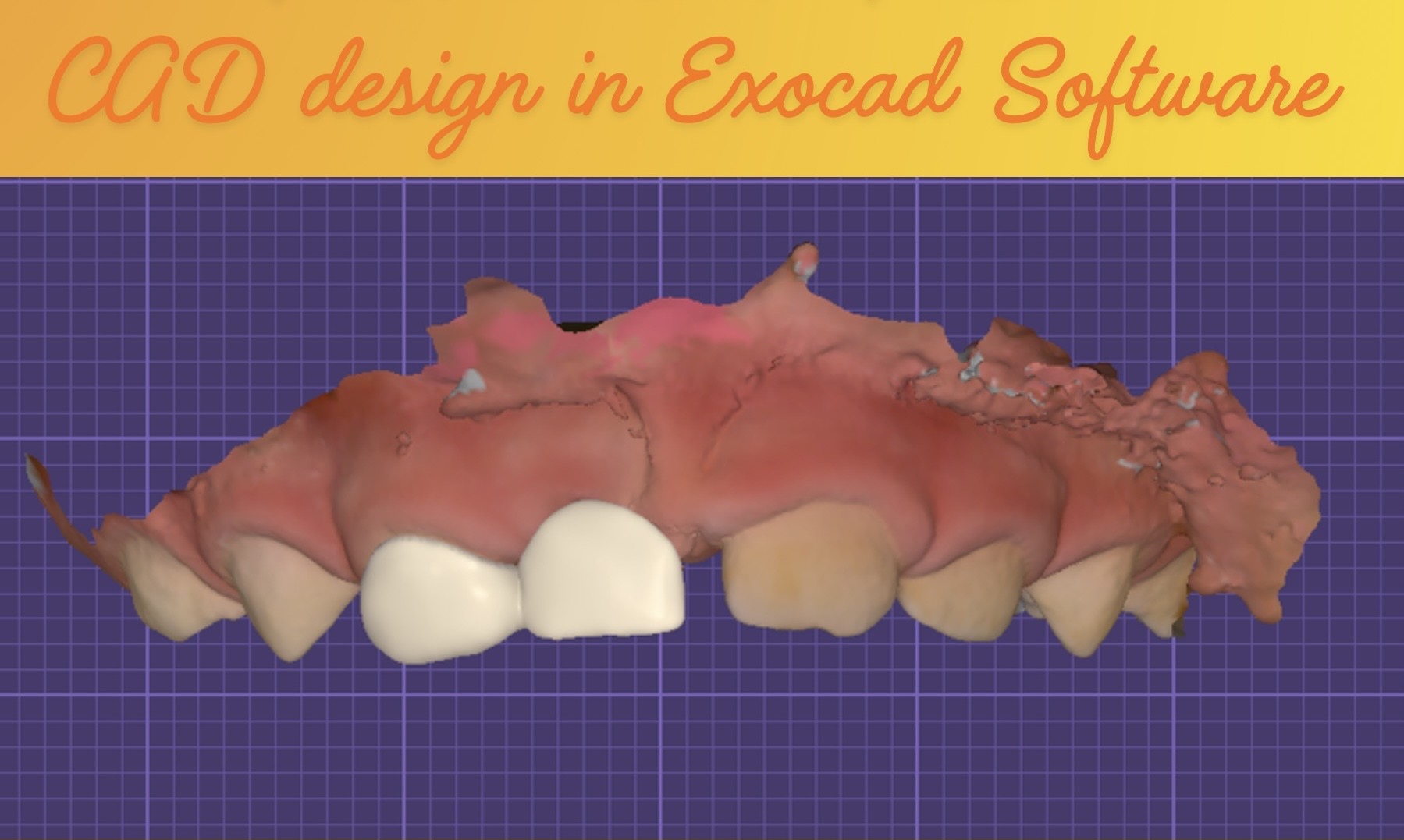 printismile-intraoral-scans-clinical-photos-primary-teeth