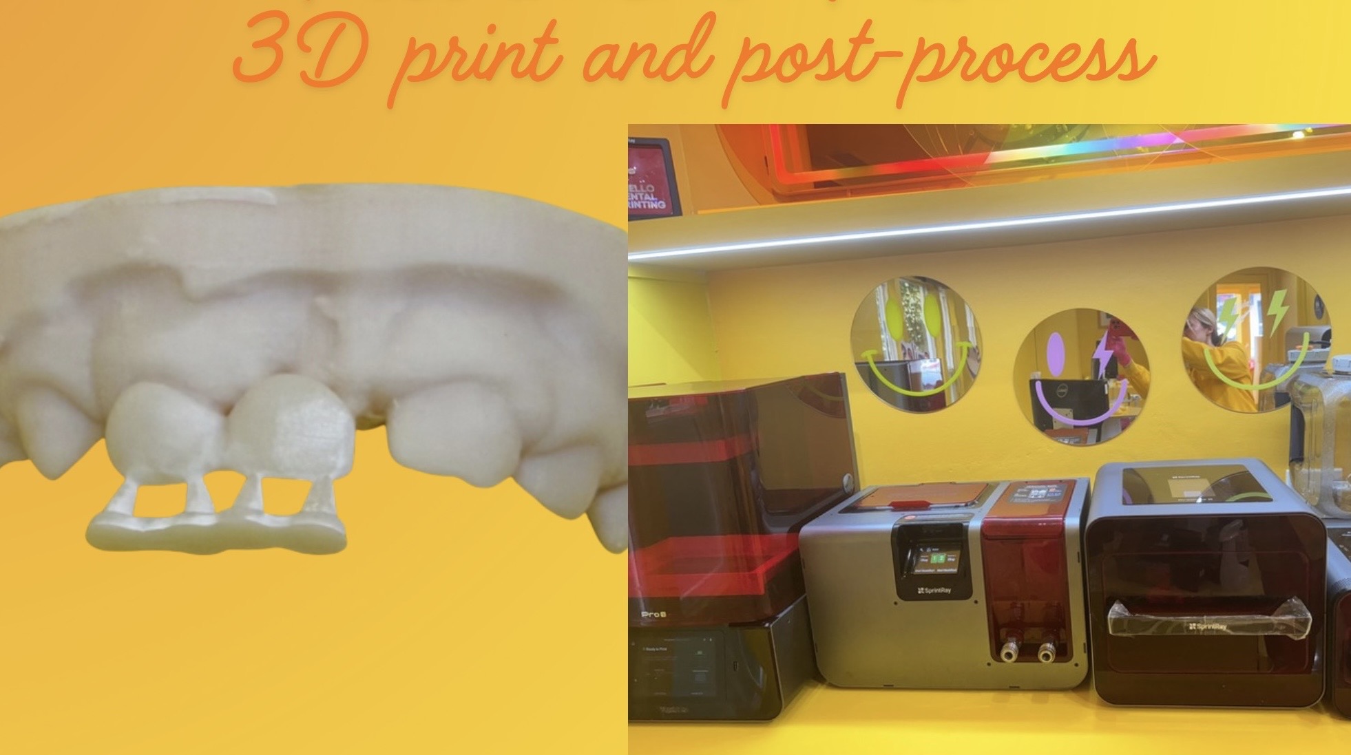 printismile-intraoral-scans-clinical-photos-primary-teeth