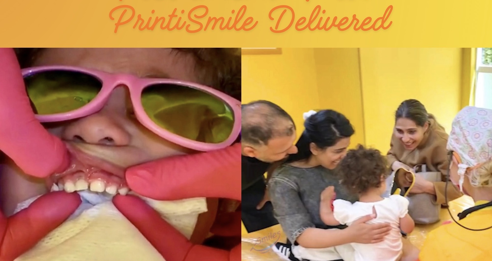 printismile-intraoral-scans-clinical-photos-primary-teeth