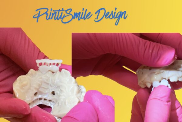 printismile-intraoral-scans-clinical-photos-primary-teeth