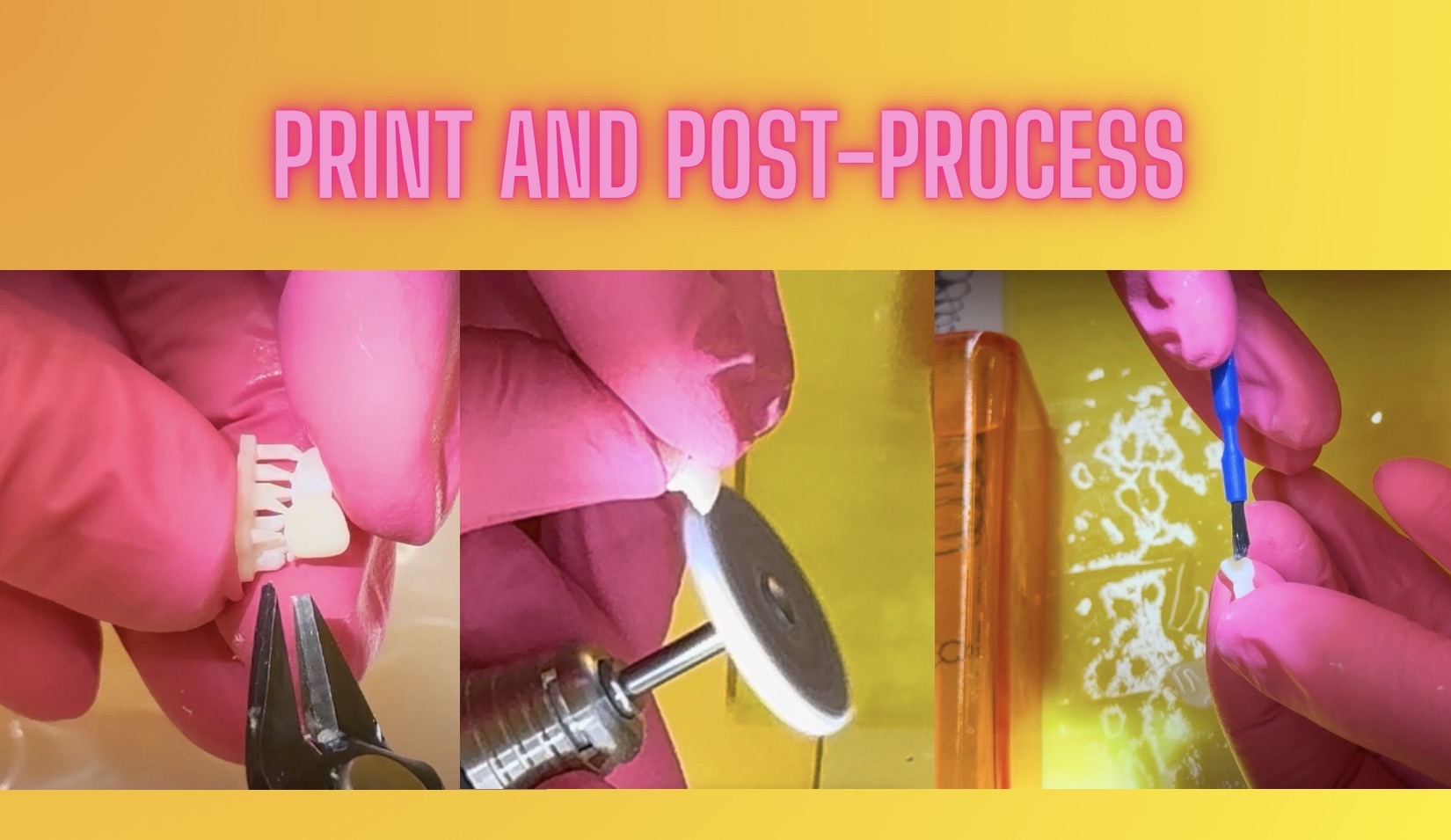 printismile-intraoral-scans-clinical-photos-primary-teeth